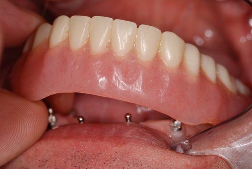 Dental Innovations