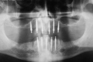 Dental Innovations
