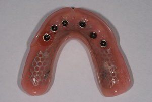 Dental Innovations