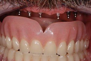 Dental Innovations