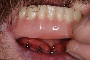 Dental Innovations