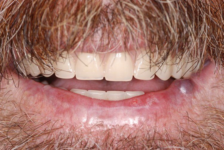 Dental Innovations
