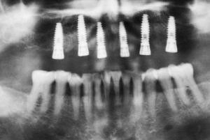 Dental Innovations