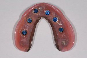 Dental Innovations