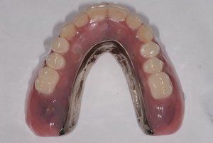 Dental Innovations