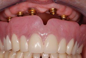 Dental Innovations