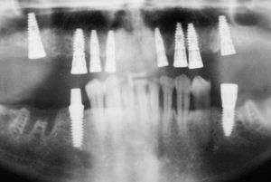 Dental Innovations