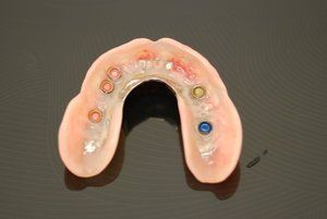 Dental Innovations