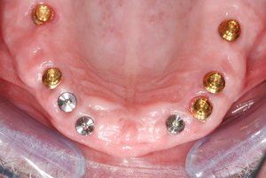 Dental Innovations