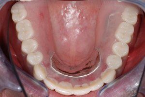 Dental Innovations