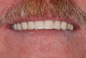 Dental Innovations