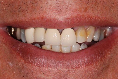 Dental Innovations