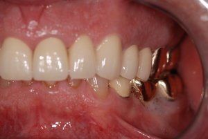 Dental Innovations