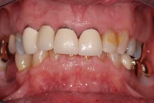 Dental Innovations