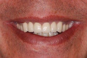 Dental Innovations