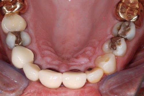 Dental Innovations