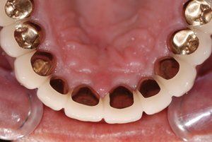 Dental Innovations
