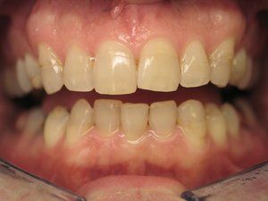 Dental Innovations