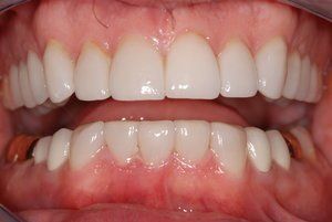 Dental Innovations