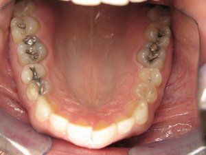 Dental Innovations