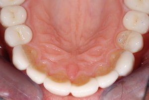 Dental Innovations