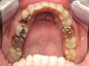 Dental Innovations