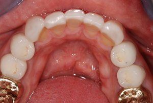 Dental Innovations