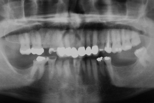 Dental Innovations