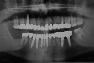 Dental Innovations
