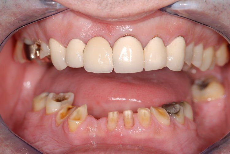 Dental Innovations