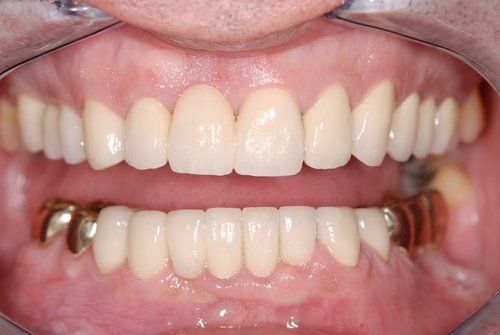 Dental Innovations