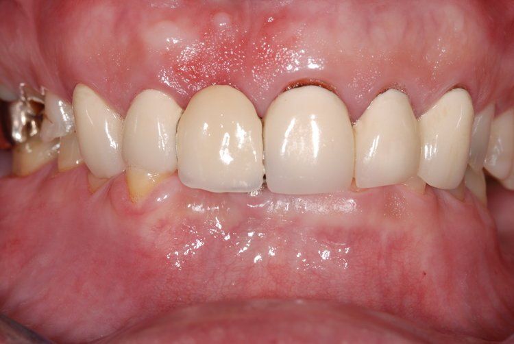 Dental Innovations