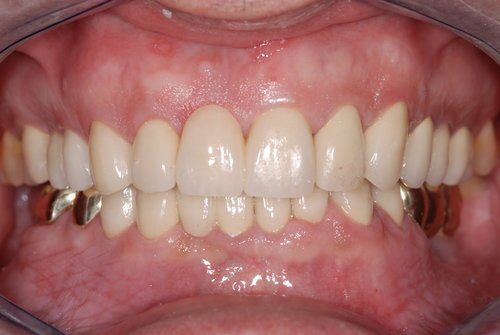 Dental Innovations
