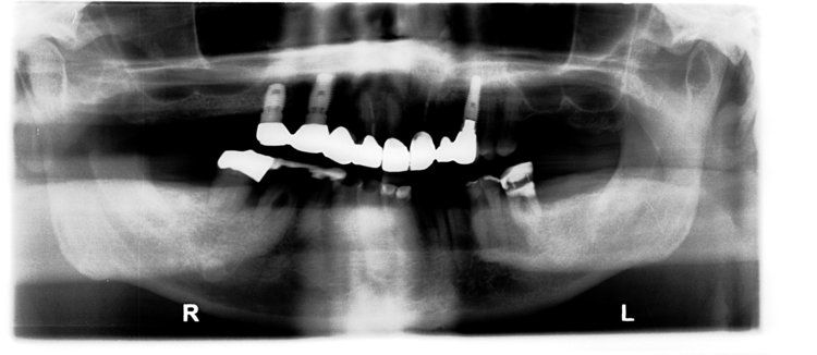 Dental Innovations
