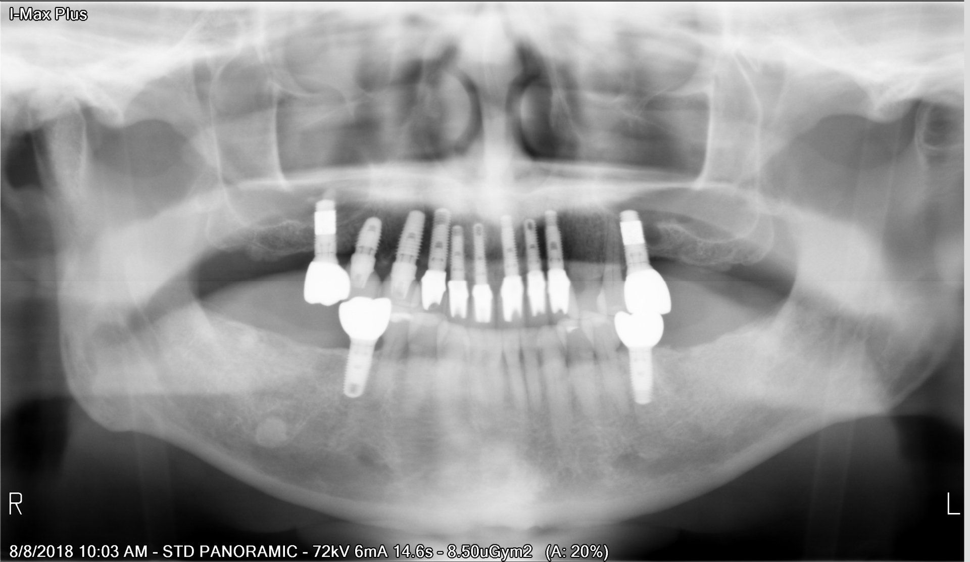 Dental Innovations
