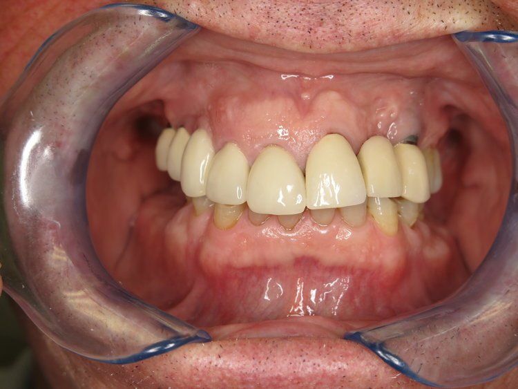 Dental Innovations