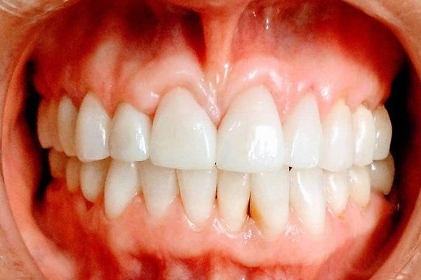Dental Innovations