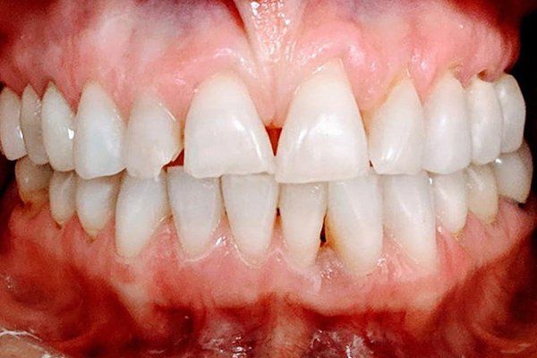Dental Innovations