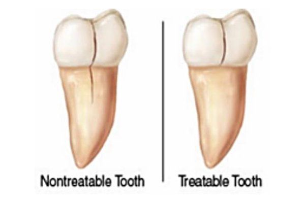 Dental Innovations