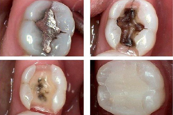 Dental Innovations