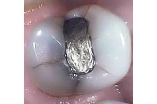 Dental Innovations