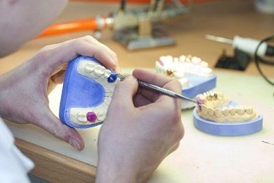 Studio su impronta dentaria