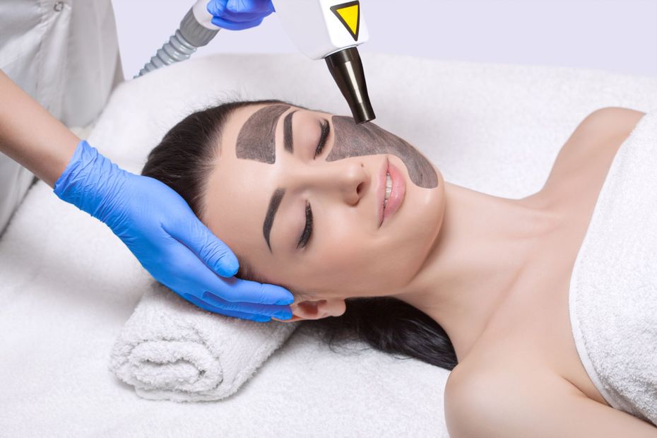 Peeling viso