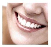 veneers in Chapel Hill, cosmetic dentist