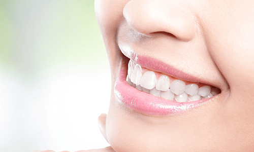 Dental care