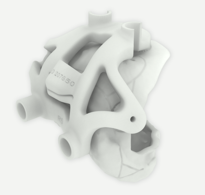 example femoral cutting guide with bone model