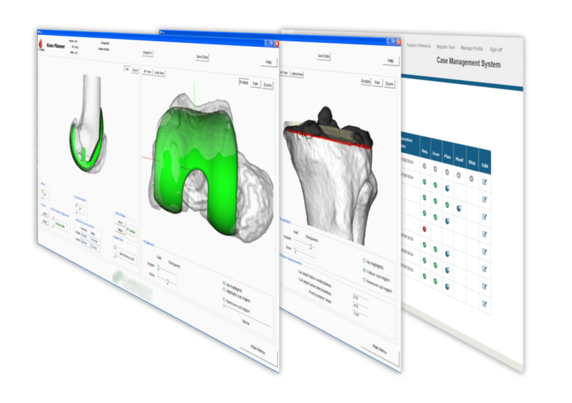 Case planning software and CMS screenshots