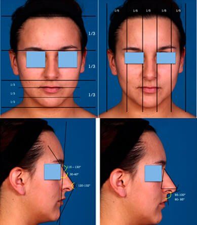 Guía de análisis facial: vistas frontales y de perfil con líneas y ángulos para medir proporciones y rasgos faciales.