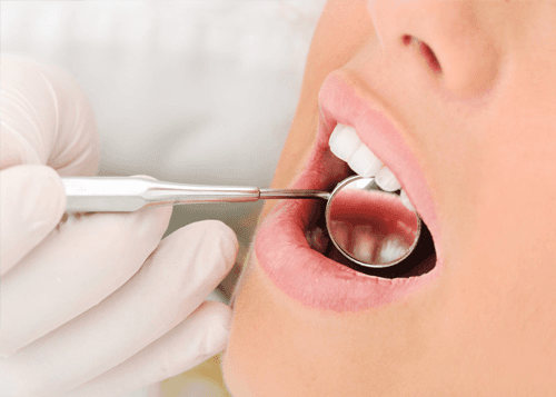 Tooth decay
