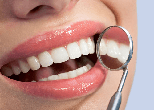 White fillings